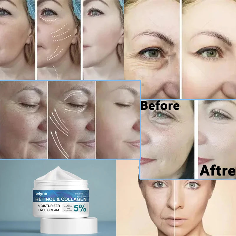 Retinol Anti-wrinkle Cream For Men Collagen Anti-Aging Removal Face & Neck Wrinkle Efficient Moisturize Firming Korean Skin Care