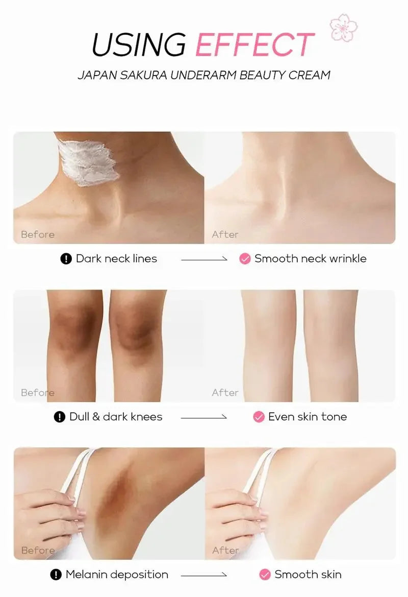 Whitening Cream Private Parts Underarm Bleaching Serum Whiten Butt Knee Brighten Inner Thigh Intimate Parts Dark Remove Melanin