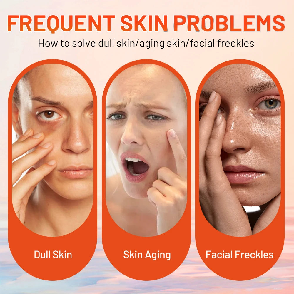 Whitening Face Cream Moisturizing Freckle Cream Remove Melasma Inhibit Dark Spots Pigment Melanin Anti Wrinkle Beauty Health