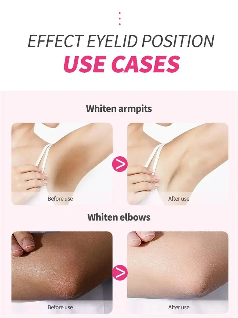 Whitening Cream Private Parts Underarm Bleaching Serum Whiten Butt Knee Brighten Inner Thigh Intimate Parts Dark Remove Melanin