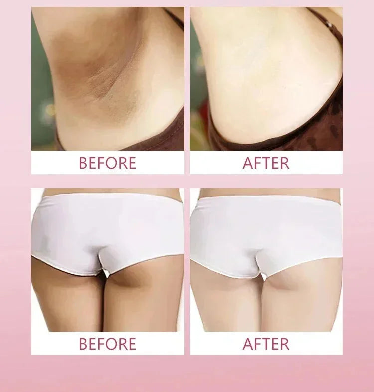 Whitening Cream Private Parts Underarm Bleaching Serum Whiten Butt Knee Brighten Inner Thigh Intimate Parts Dark Remove Melanin