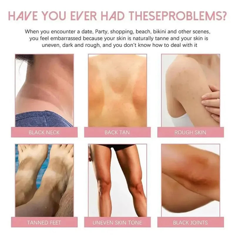 Whitening Cream Private Parts Underarm Bleaching Serum Whiten Butt Knee Brighten Inner Thigh Intimate Parts Dark Remove Melanin