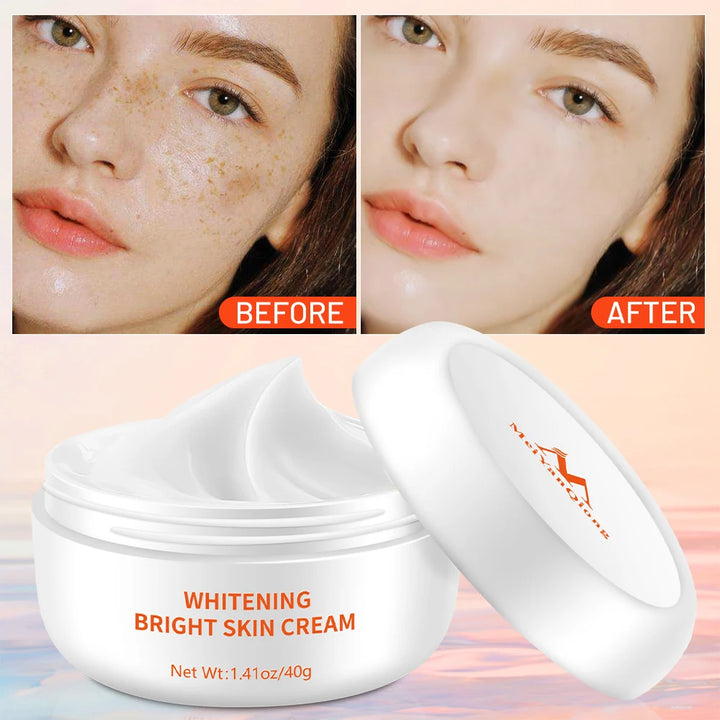 Whitening Face Cream Moisturizing Freckle Cream Remove Melasma Inhibit Dark Spots Pigment Melanin Anti Wrinkle Beauty Health