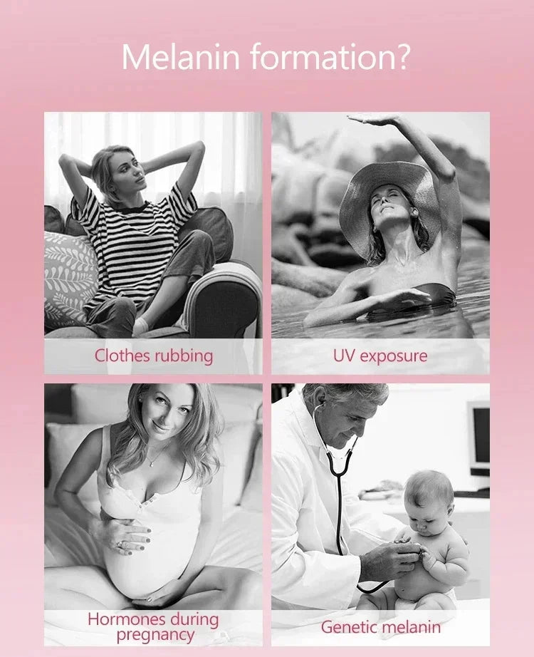 Whitening Cream Private Parts Underarm Bleaching Serum Whiten Butt Knee Brighten Inner Thigh Intimate Parts Dark Remove Melanin