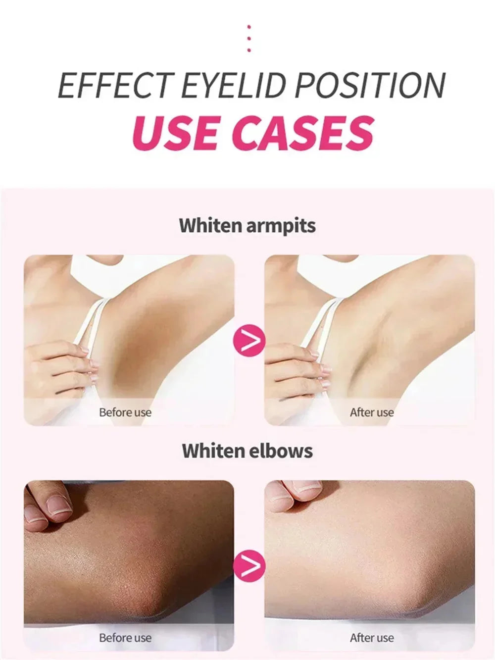 Whitening Cream Private Parts Underarm Bleaching Serum Whiten Butt Knee Brighten Inner Thigh Intimate Parts Dark Remove Melanin