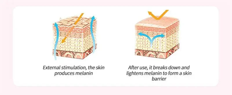 Whitening Cream Private Parts Underarm Bleaching Serum Whiten Butt Knee Brighten Inner Thigh Intimate Parts Dark Remove Melanin