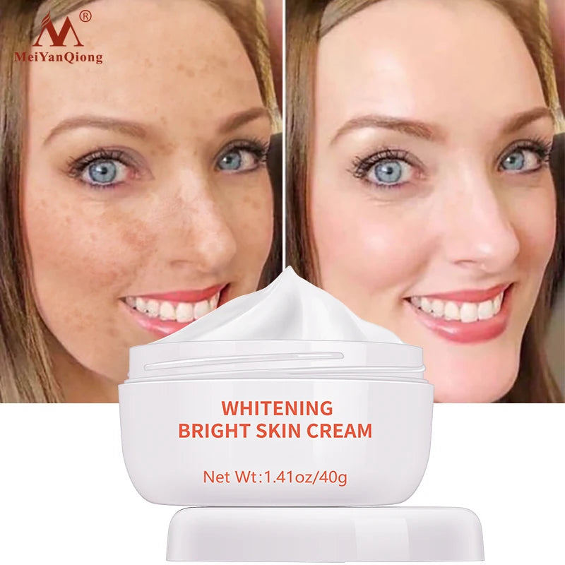 Whitening Face Cream Moisturizing Freckle Cream Remove Melasma Inhibit Dark Spots Pigment Melanin Anti Wrinkle Beauty Health