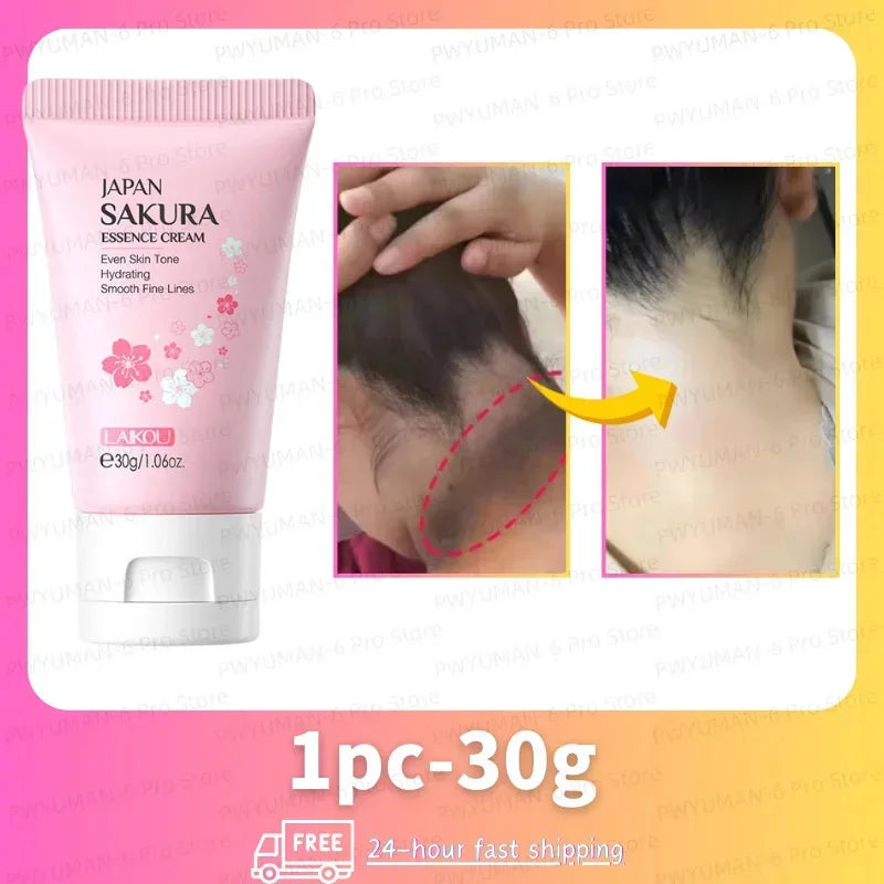 Whitening Cream Private Parts Underarm Bleaching Serum Whiten Butt Knee Brighten Inner Thigh Intimate Parts Dark Remove Melanin