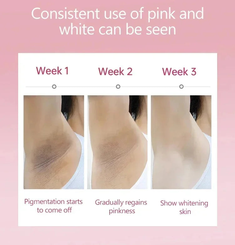 Whitening Cream Private Parts Underarm Bleaching Serum Whiten Butt Knee Brighten Inner Thigh Intimate Parts Dark Remove Melanin